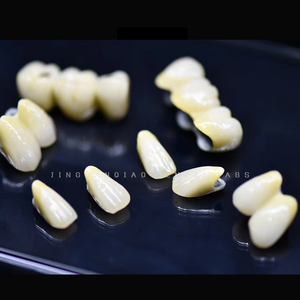 Implantes personalizados Solución de reemplazo dental Implantes dentales con el cuidado adecuado - Product Image 6