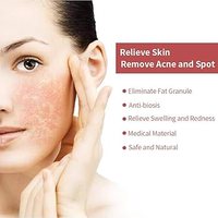 980 araignée varices visage Remove Diode Laser dispositif 980nm jambe varices traitement dispositif