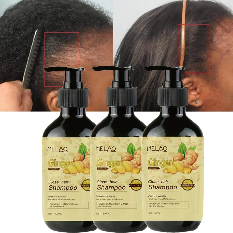 Shampooing 2-en-1 au gingembre pour la croissance des cheveux 300ml Formule nourrissante anti-chute pour hommes et femmes