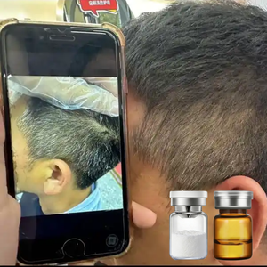 ผงสมุนไพรบำรุงหนังศีรษะ OEM ป้องกันผมหงอก บำรุงเส้นผม ลดการเกิดผมหงอกเป็นธรรมชาติ ช่วยฟื้นฟู<span class=keywords><strong>ผม</strong></span>ขาวให้กลับมาดำ - Product Image 1