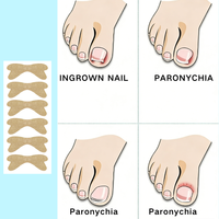 Boîte d'outils professionnels portables de haute qualité pour le soin des ongles, patchs correcteurs auto-adhésifs sans colle en forme de papillon pour les ongles des pieds