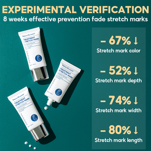 VIBRANT GLAMOUR-Crema corporal para eliminar cicatrices de <span class=keywords><strong>embarazo</strong></span>, tratamiento de marcas elásticas - Product Image 5