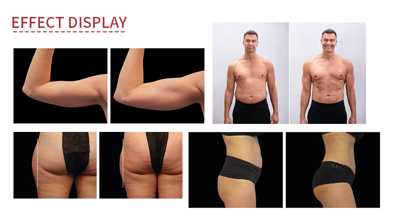 Vertical EMS Muscle Building Machine Body Slimming Electromagnetic Muscle Stimulator