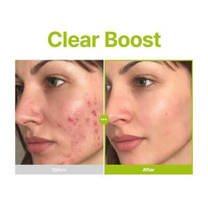 Sérum facial PURITO 10% à l'acide kojique et à l'huile d'arbre à thé & B5 pour les éruptions cutanées, prix de gros pour les soins de la peau coréens originaux - Product Image 6