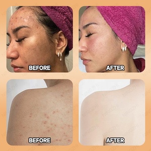 Bán buôn 100% tự nhiên hữu cơ handmade tumeric da kojic xà phòng dịu dàng chăm sóc da vẻ đẹp - Product Image 5