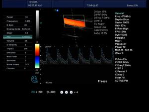 12-Zoll-LED-Bildschirm Tragbares Diagnose system Veterinär instrument 2D-Notebook-<span class=keywords><strong>Laptop</strong></span> für Farbdoppler-Ultraschall gerät - Product Image 6