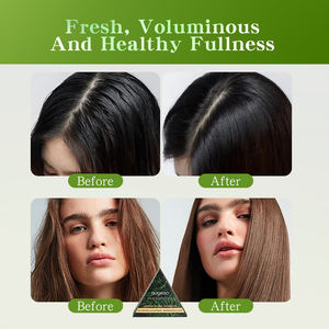 Champú Sólido Personalizado para el Cuidado del Cabello, Champú Herbal Orgánico Natural Hecho a Mano, Control de Grasa, Champú Sólido de Hierba Usman - Product Image 6