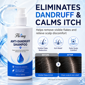 Shampoo antipelliculaire pour <span class=keywords><strong>cuir</strong></span> <span class=keywords><strong>chevelu</strong></span> qui démange et qui présente des pellicules, shampooing clarifiant pour cheveux gras pour hommes et femmes, soin du <span class=keywords><strong>cuir</strong></span> <span class=keywords><strong>chevelu</strong></span> sans sulfate - Product Image 2