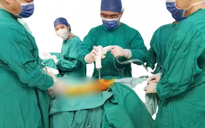 Instruments chirurgicaux jetables de haute qualité pour lavage pulsé, certifiés CE ISO, pour usage vétérinaire et humain, très demandés - Product Image 3