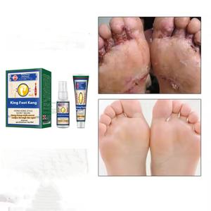 Herbal <span class=keywords><strong>Natural</strong></span> Eficaz para la reparación de hongos en las uñas Crema para el pie para la eliminación de hongos en las uñas Ungüento y aerosol Suministro de atención médica - Product Image 2