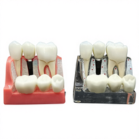 Modèle d'analyse dentaire 4 fois agrandi pour implants, couronnes, bridges, démonstration, modèle amovible, modèle d'enseignement et de formation pour dentistes