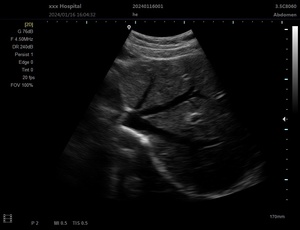 Appareil d'échographie numérique portable pour vétérinaires, scanner d'imagerie diagnostique vétérinaire noir et blanc - Product Image 4