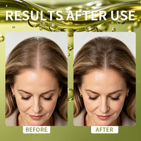 Shampooing Botanique Soin du Cuir Chevelu Marque Blanche avec Extrait de Biota Contrôle du Sébum Anti-Acné OEM ODM Marque Personnalisée Vente en Gros