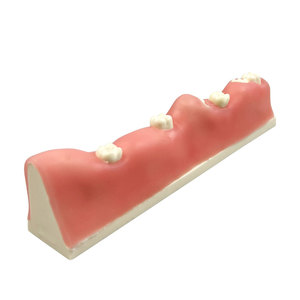 Modelo Dental de Diente Impactado a Precio de Fábrica, Modelo de Diente Sin Eruptura para Prácticas Dentales, Adecuado para Enseñanza e Investigación Dental - Product Image 4