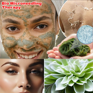 Terapia de Biomicroneedling OEM/ODM con Espículas de Esponja para Eliminar el Acné del Rostro y la Nariz, Antialérgico, Sin Sulfatos, Sin Ácidos, Sin Uso Médico - Product Image 2