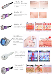 AU-61E Kim 8 Sistema de Adelgazamiento, Cavitación al Vacío, Radiofrecuencia y Terapia de Luz LED, Masaje Facial RF, Equipo 8 en 1 - Product Image 5