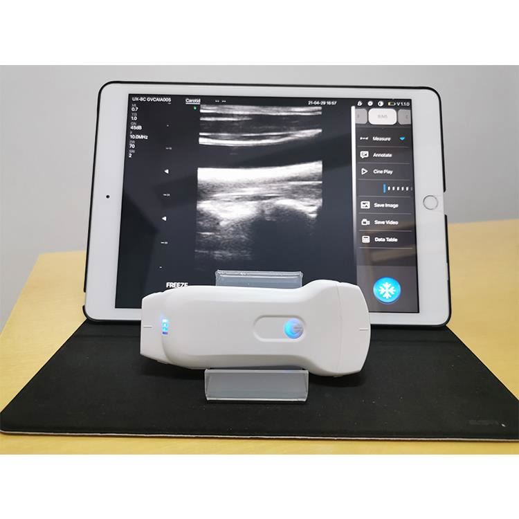 Probe Ganda Nirkabel Hemat Biaya Tertinggi PICC Ultrasound Probe Smartphone Wifi Linear Convex Wireless Ultrasound Probe