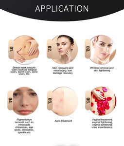 Dispositivo de Terapia de Estrías con Tecnología Láser de CO2 Fraccional de Precisión y Seguridad, Clase Médica, en Existencia - Product Image 6