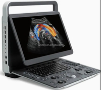 Dispositivo de Ultrasonido Veterinario Portátil Sonoscape E1 EXP V con Monitor HD de 15.6 Pulgadas, Película Protectora Impermeable, Doppler a Color