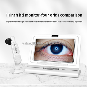Eyeball High Definition Eye Imaging Tool with Integrated Screen Eye Health Monitor Multi Standard Universal Use - Product Image 2