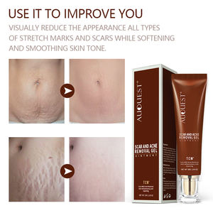 Crème gel <span class=keywords><strong>pommade</strong></span> réparatrice <span class=keywords><strong>de</strong></span> cicatrices et d'acné à base <span class=keywords><strong>de</strong></span> plantes biologiques à étiquette privée, TCM profond, réparation des vergetures - Product Image 4