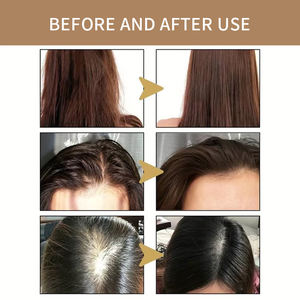 Balsamo all'Olio di Ricino OEM a Base Vegetale Idratante Anti-Crespo Previene la Rottura per Capelli Lucenti - Product Image 5