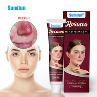 Pommade de rosacée à base de plantes chinoises crème d'acné de nez rouge soulager les rougeurs de la peau plâtre médical rétrécir les Pores