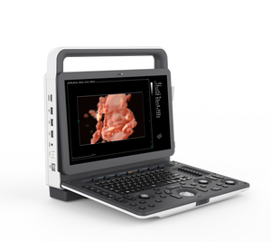 Draagbaar 3d4d Verloskundig Echografiesysteem Met Hartscreening-Volumetrische Imagin Voor Prenatale Diagnose Foetale Echocardiografie - Product Image 1
