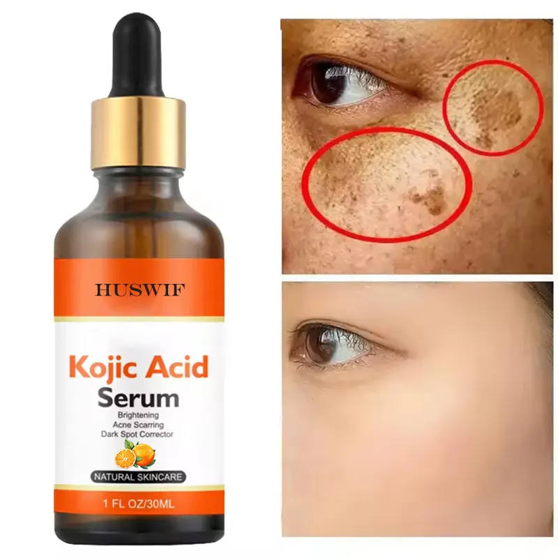 Serum asam Kojic Label pribadi korektor noda gelap pemutih pencerah untuk Wajah & tubuh dengan Alfa Arbutin, Niacinamide