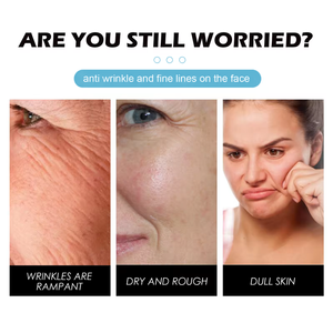 Crème pour le <span class=keywords><strong>visage</strong></span> infusée à la vitamine E, <span class=keywords><strong>meilleure</strong></span> crème réparatrice à l'escargot pour une peau claire, collagène hydratant, anti-rides, réparation anti-âge - Product Image 2