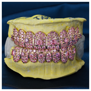 Kişiye Özel Kusursuz Büyük Taşlı Buzlu Diş Grillzleri S925 Gümüş 10K 14K 18K Som Altın Pembe Mozanit Elmas Üçüncü Parti - Product Image 1