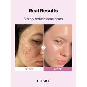 [Solo para Nigeria] [COSRX] Suero de Niacinamida 15% de Alta Concentración 20ml como Suero Facial para Control de Sebo y No Comedogénico para el Acné - Product Image 6