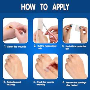 YOJO Apósito Hidrocoloide Flexible, Impermeable, Autoadhesivo, Ultra Absorbente, Esterilizado con EO, Certificado CE, para Heridas, de Tamaño y Forma Personalizables - Product Image 4