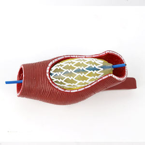 Modelo <span class=keywords><strong>de</strong></span> stent vascular <span class=keywords><strong>de</strong></span> ciencia médica modelo vascular humano enseñanza médica modelo <span class=keywords><strong>de</strong></span> <span class=keywords><strong>anatomía</strong></span> vascular <span class=keywords><strong>patológica</strong></span> - Product Image 3