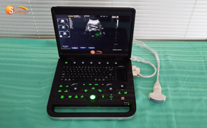 SUN-902B hot-bán y tế siêu âm DOPPLER màu siêu âm 2D Vet sử dụng máy tính xách tay usg máy siêu âm - Product Image 6
