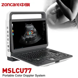 Zoncare M5 3D 4D 5D Echografie Machine Draagbare Ultrasound Machine Prijs In Pakistan