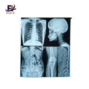 Film radiographique <span class=keywords><strong>dentaire</strong></span> <span class=keywords><strong>panoramique</strong></span> Offre Spéciale - Product Image 5