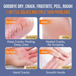 Crema de Manos Anti-Congelante y Anti-Agrietamiento <span class=keywords><strong>DR</strong></span>.YMR, Hidratación Profunda, Reparación de Piel Descamada, Bálsamo para el Frío Invernal, Ingredientes y Fragancia - Product Image 4