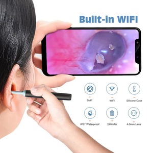 휴대용 무선 이경 카메라 지능형 전동 귀 청소기 타겟 귀지 제거 - Product Image 2
