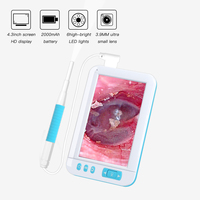 Caméra dissolvant de cire d'oreille 5.5mm HD1080P Ent Endoscope 4.3 pouces HD écran caméra numérique oreille moniteur Earpick