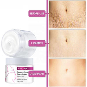 Crema blanqueadora de la piel Vergetures, Etiqueta Privada, crema para <span class=keywords><strong>eliminar</strong></span> estrías en el embarazo - Product Image 3