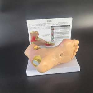 Modelo de Órgano Objetivo para la Complicación de Enfermedades por Azúcar, Modelo de Modelo Patológico de Hipertensión del Pie con Piedra del Viento y Modelo de Articulación del Pie - Product Image 3