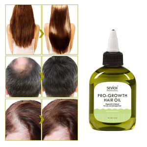 <span class=keywords><strong>Aceite</strong></span> orgánico <span class=keywords><strong>para</strong></span> tratamiento <span class=keywords><strong>de</strong></span> pérdida <span class=keywords><strong>de</strong></span> <span class=keywords><strong>cabello</strong></span> profesional, <span class=keywords><strong>aceite</strong></span> <span class=keywords><strong>de</strong></span> hierbas <span class=keywords><strong>de</strong></span> crecimiento rápido <span class=keywords><strong>para</strong></span> <span class=keywords><strong>el</strong></span> crecimiento del <span class=keywords><strong>cabello</strong></span> - Product Image 4