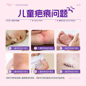 Gel cicatrisant pour enfants OEM 15g, dispositif médical pour la réparation et l'amélioration des cicatrices - Product Image 5
