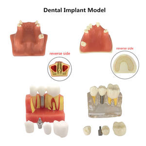 Hars tandmodel tanden onderwijs tandheelkunde studie verwijderbare orthodontische implantaat praktijk training opleiding - Product Image 6