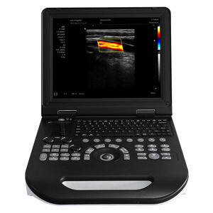 Nouvelle machine à ultrasons Doppler couleur chariot portable d'équipements médicaux avancés Sonoscape - Product Image 1