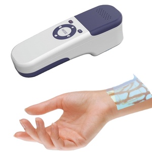 Alat Medis Portabel Pencari Vena Genggam Detektor Vena Pencari Urat - Product Image 1