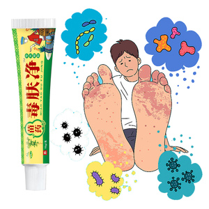 中国制造商批发天然草本提取物私用湿疹霜真菌止痒软膏 - Product Image 2
