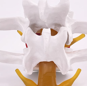 인체 요추 1.5배 확대 척추 의학 교육용 뼈 모형 (인체 요추 디스크 돌출) 의료 학생 실습 교육용 - Product Image 3