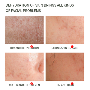 CINDYNAL Birch Moisturizing <strong>Cream</strong> Sodium Hyaluronate Imported From <strong>UK</strong> - Product Image 3